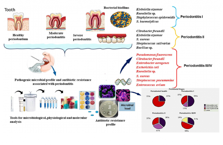 Pathogenic Microbial Profile and Antibiotic Resistance Associated