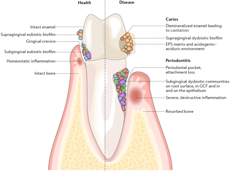 Biogeography of oral microbiota colonization in the diverse habitats of the oral cavity.