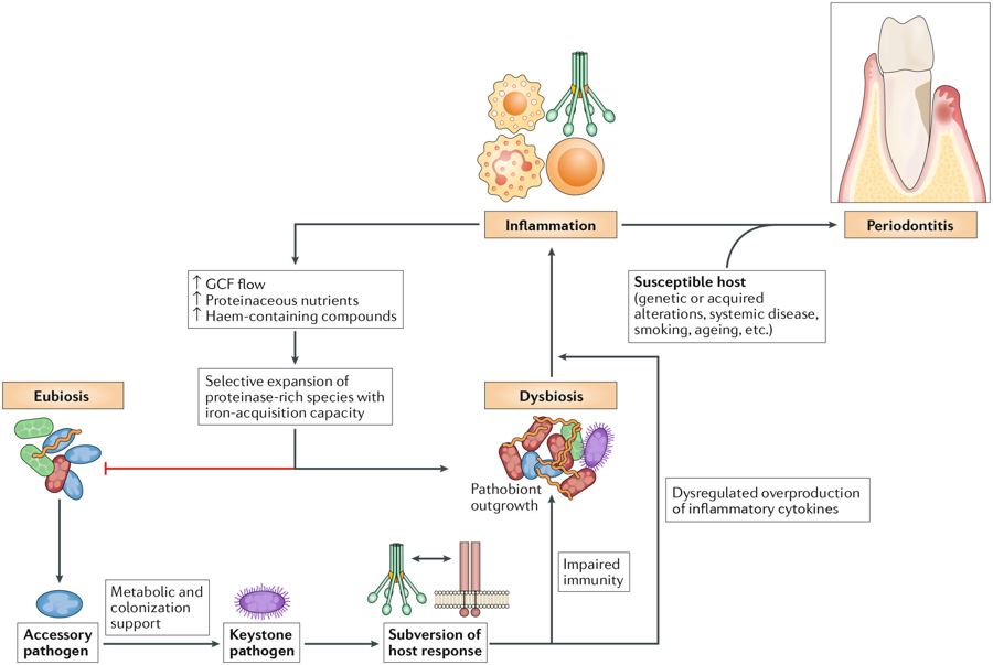 Interactiunea reciproca dintre disbioza si inflamatie in periodontita cronica
